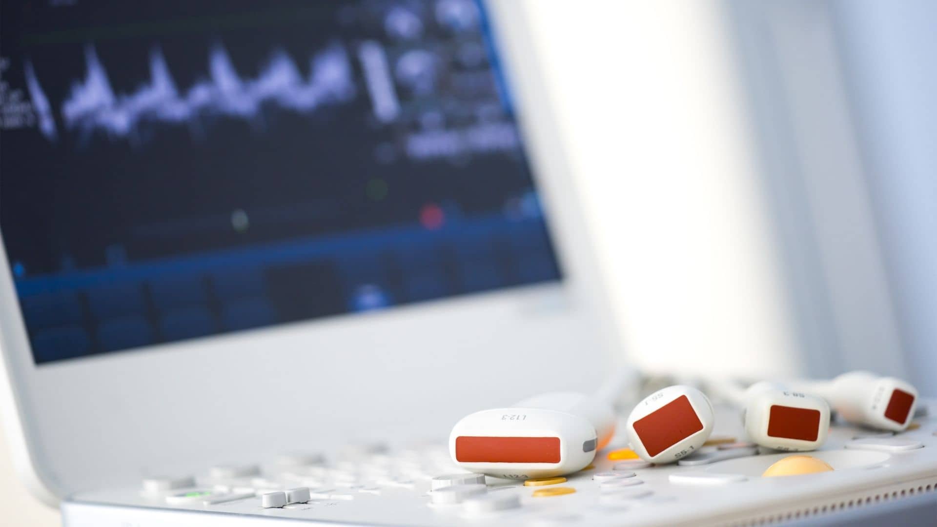 An ultrasound machine with a screen showing heart waveforms and multiple probes, used in medical imaging procedures.