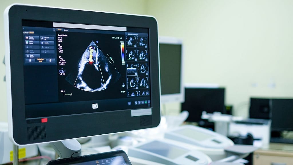 Image from MCBO highlighting patient benefits of proper 93306 CPT code billing, reducing wait times for follow-up care by 30% and improving heart disease management outcomes, with a financial documents and calculator graphic.