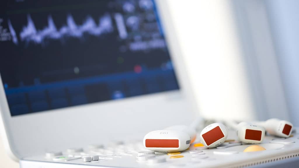 An ultrasound machine with a screen showing heart waveforms and multiple probes, used in medical imaging procedures.