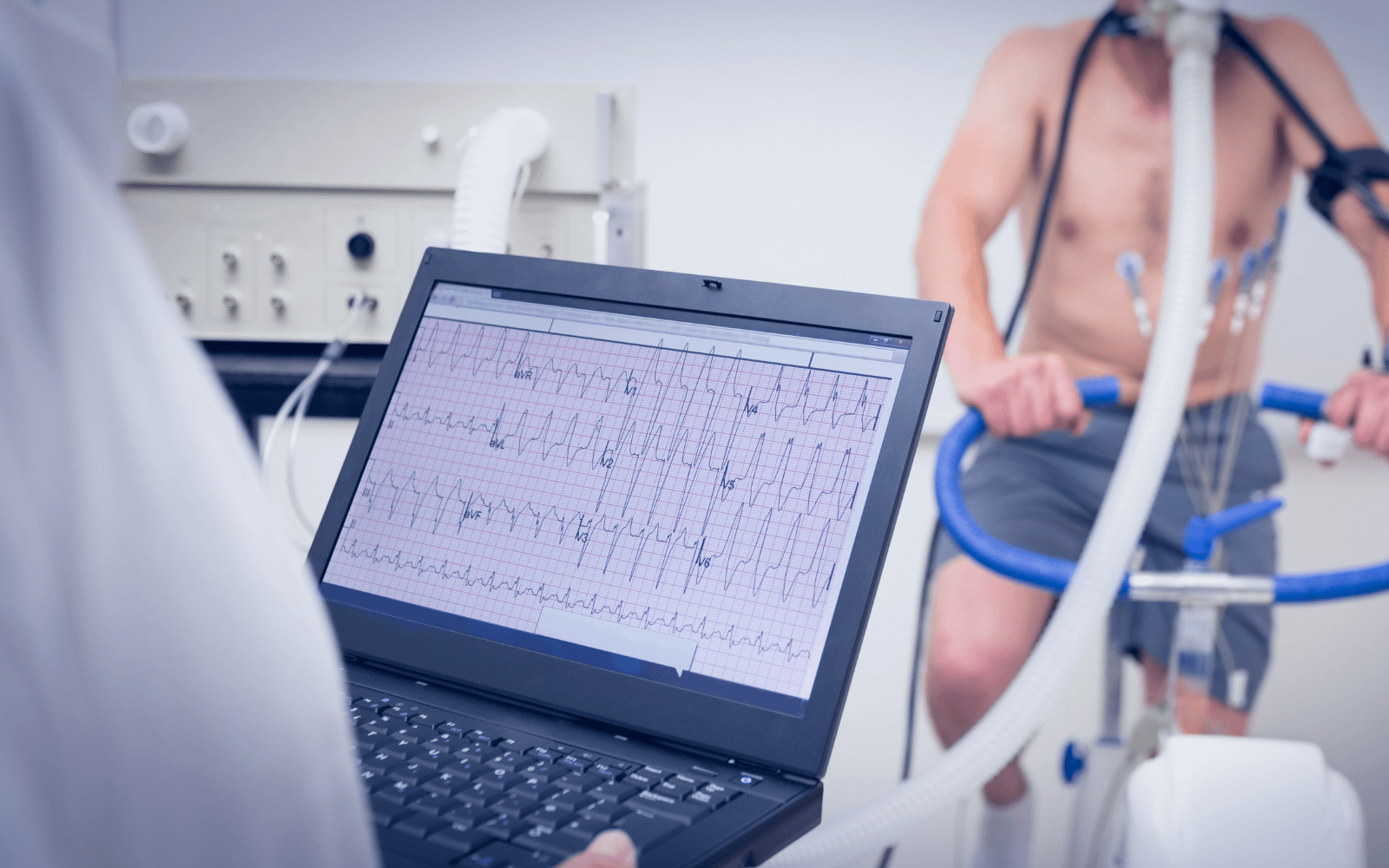 Cardiac stress test equipment showing EKG monitoring for CPT code 93016 billing procedures